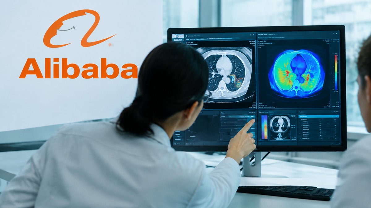 Alibaba dévoile deux intelligences artificielles pour la détection précoce des cancers